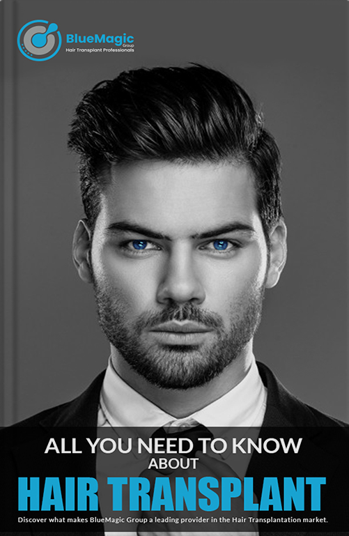 All you need to know about hair transplant
